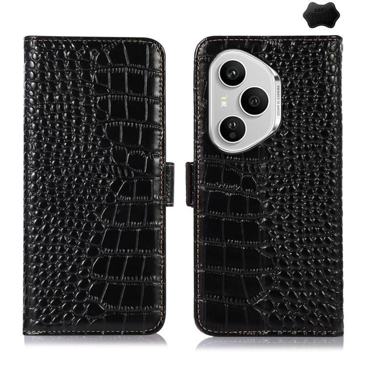 For Honor 400 Pro Global 160.8mm Crocodile Top Layer Cowhide Leather Phone Case(Black)
For Honor 400 Pro Global 160.8mm Crocodile Top Layer Cowhide Leather Phone Case(Black)