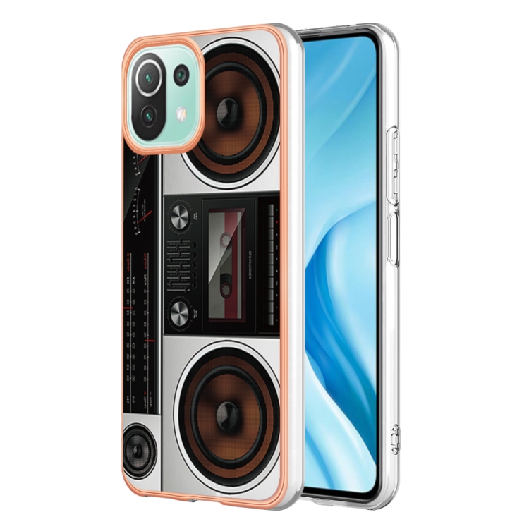 For Xiaomi 11 Lite Electroplating Marble Dual-side IMD Phone Case(Retro Radio)
For Xiaomi 11 Lite Electroplating Marble Dual-side IMD Phone Case(Retro Radio)