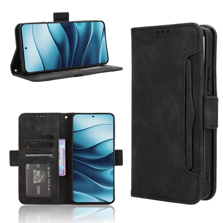 For Redmi Note 14 4G Global 163.25mm Skin Feel Calf Texture Card Slots Leather Phone Case(Black)
For Redmi Note 14 4G Global 163.25mm Skin Feel Calf Texture Card Slots Leather Phone Case(Black)