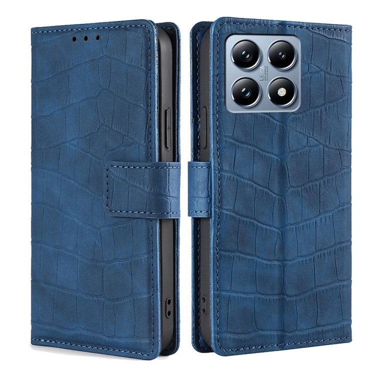 For Xiaomi 14T Pro 5G Skin Feel Crocodile Magnetic Clasp Leather Phone Case(Blue)
For Xiaomi 14T Pro 5G Skin Feel Crocodile Magnetic Clasp Leather Phone Case(Blue)