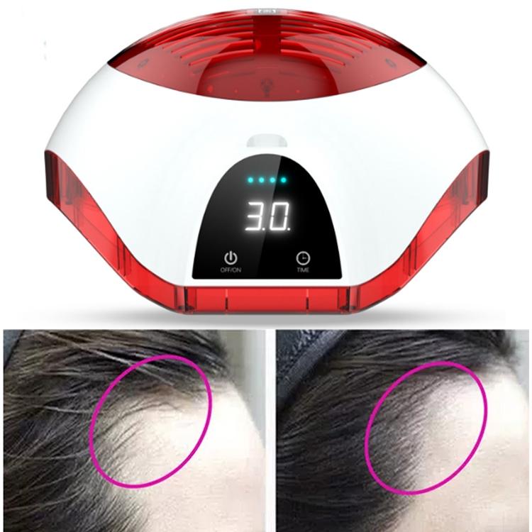 LCD Display Laser Therapy Hair Growth Helmet Anti Hair Loss Device Promote Hair  Regrowth Cap(Black White Red)
