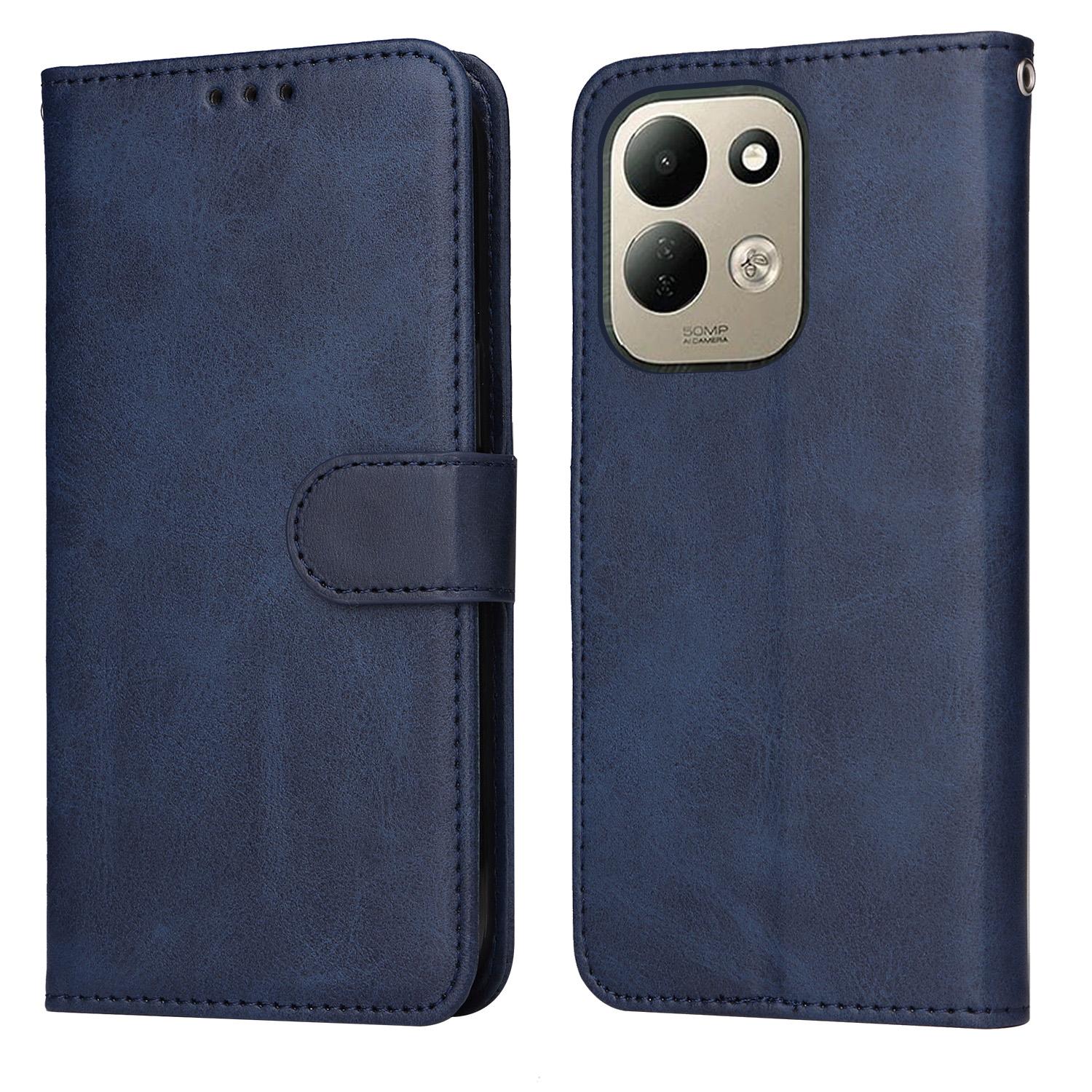 For Redmi 17 5G / 4G Global 170mm Classic Calf Texture Flip Leather Phone Case(Blue) - Shopkiz.com