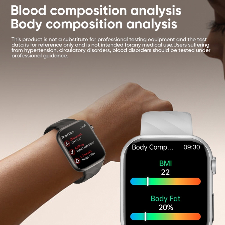 Apple Saat Iphone Horloge Mediamarkt Apple Watch Dames Aanbieding