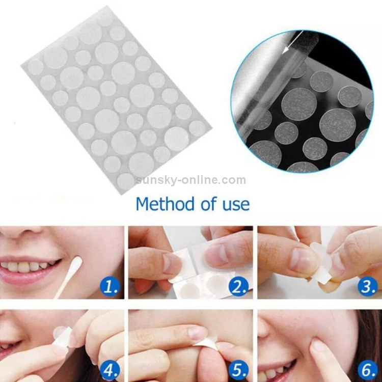 Complete Acne Care Solution: a three-piece professional stainless steel pimple extractor tool set