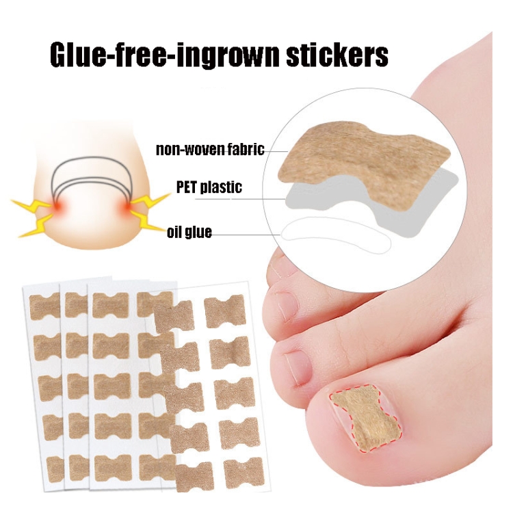 10 PCS Glue-free Orthopedic Nail Stick Toe Nail Groove Inlay Corrector(Blue  Bottom)