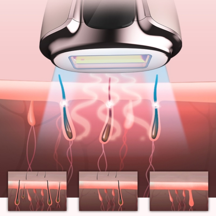 Dispositivo de depilación con láser para mujer Dispositivo de rejuvenecimiento de la piel eléctrica de IPL IPL, Forma: enchufe de la UE (lado rosa de oro rosa) - B5