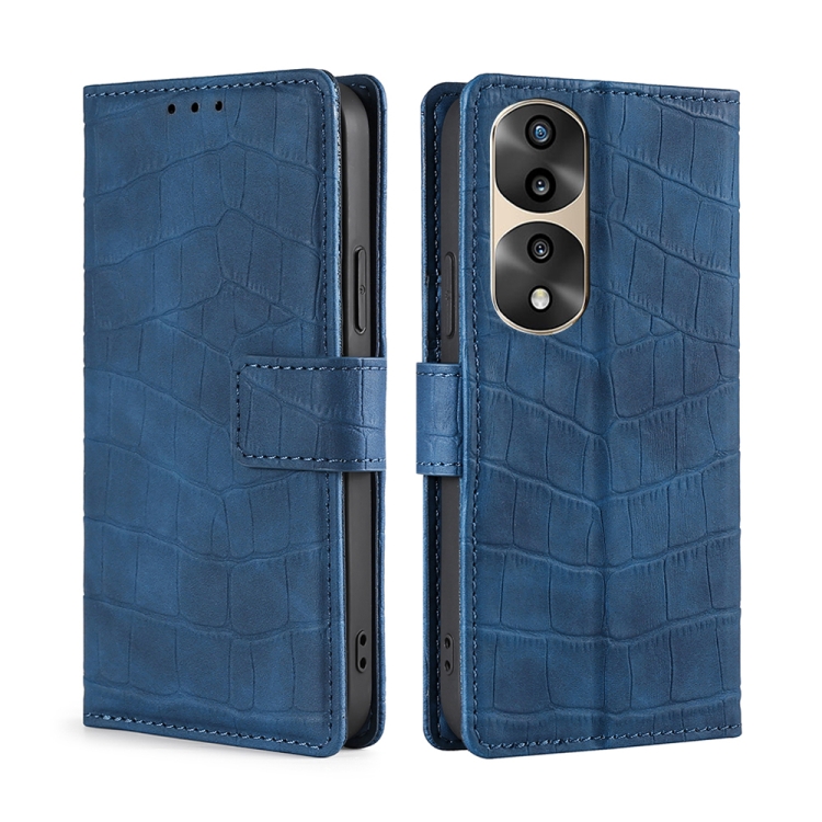 

For Honor 70 Pro/70 Pro+ Skin Feel Crocodile Magnetic Clasp Leather Phone Case(Blue)