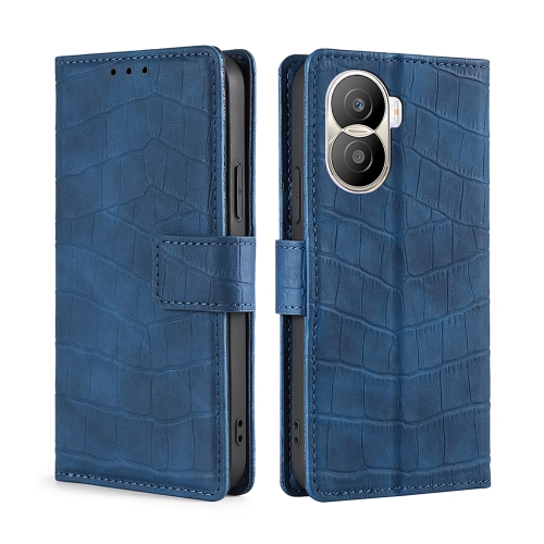 

For Honor X40i Skin Feel Crocodile Magnetic Clasp Leather Phone Case(Blue)