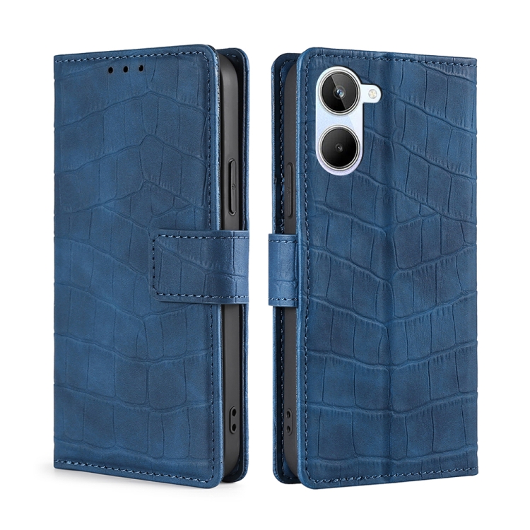 

For Realme 10 4G Skin Feel Crocodile Magnetic Clasp Leather Phone Case(Blue)