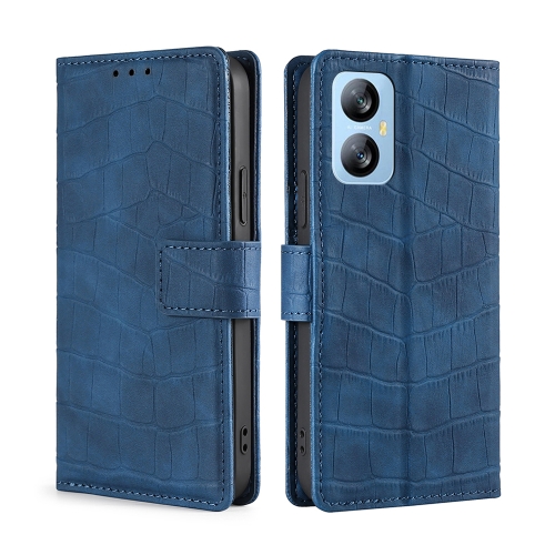 

For Blackview A52 Skin Feel Crocodile Magnetic Clasp Leather Phone Case(Blue)