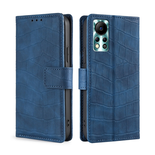 

For Infinix Hot 11s NFC Skin Feel Crocodile Magnetic Clasp Leather Phone Case(Blue)