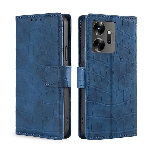 

For Infinix Zero 20 Skin Feel Crocodile Magnetic Clasp Leather Phone Case(Blue)