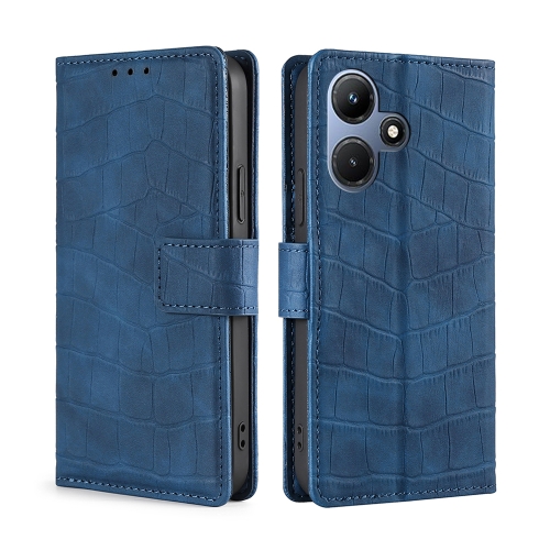 

For Infinix Hot 30i 4G Skin Feel Crocodile Magnetic Clasp Leather Phone Case(Blue)