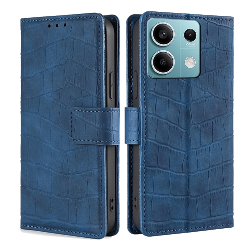 

For Xiaomi Redmi Note 13 4G Skin Feel Crocodile Magnetic Clasp Leather Phone Case(Blue)