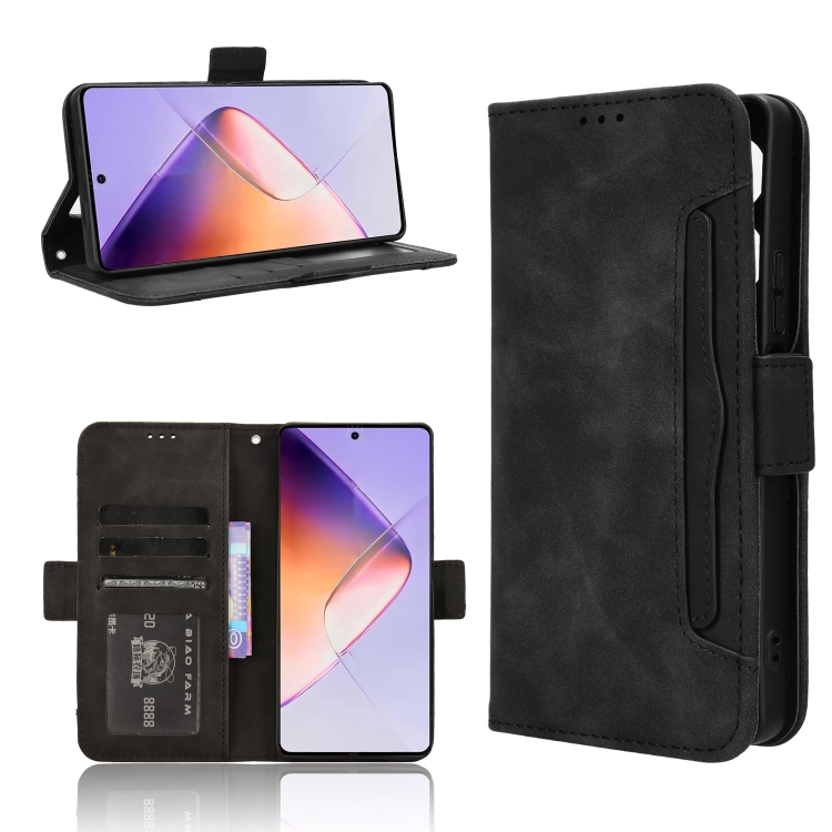 

For Infinix Note 40 4G Skin Feel Calf Texture Card Slots Leather Phone Case(Black)