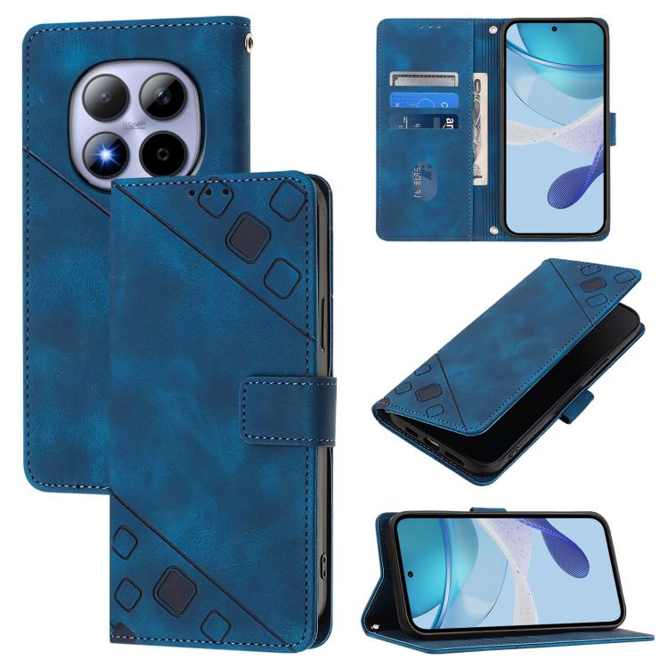 

For Redmi Note 15 Pro 5G Global 163.6mm Skin-feel Embossed Leather Phone Case(Blue)