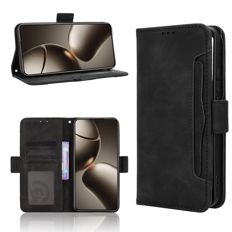 

For Xiaomi 15T 5G Skin Feel Calf Texture Card Slots Leather Phone Case(Black)
