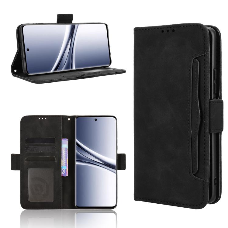 

For Redmi Note 15 5G / 4G 164mm / Poco M8 5G Skin Feel Calf Texture Card Slots Leather Phone Case(Black)