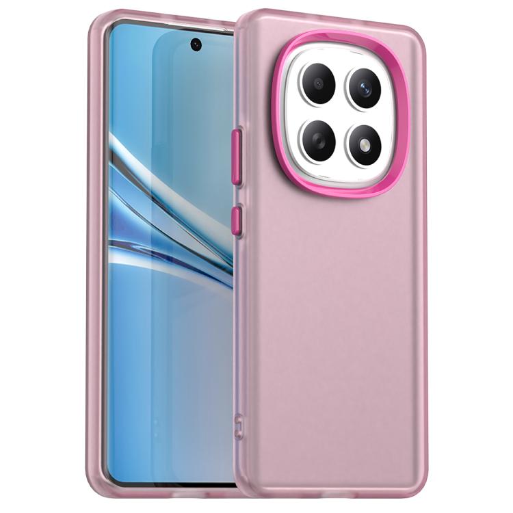 

For Redmi Note 15 5G Global 164mm Candy PC Hybrid TPU Shockproof Phone Case(Red)