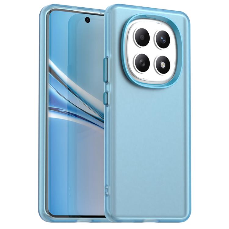 

For Redmi Note 15 5G / 4G Global 164mm Candy PC Hybrid TPU Shockproof Phone Case(Blue)