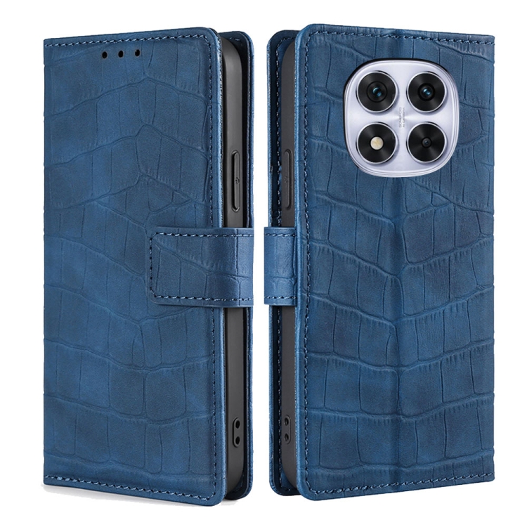 

For Redmi Note 14 Pro 5G Skin Feel Crocodile Magnetic Clasp Leather Phone Case(Blue)