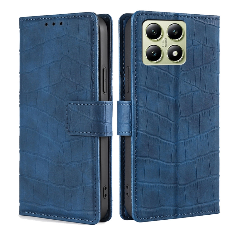 

For Xiaomi 14T 5G Skin Feel Crocodile Magnetic Clasp Leather Phone Case(Blue)