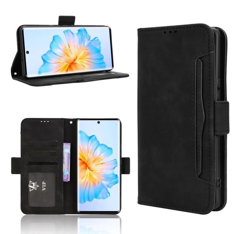

For Fossibot S3 Pro Skin Feel Calf Texture Card Slots Leather Phone Case(Black)