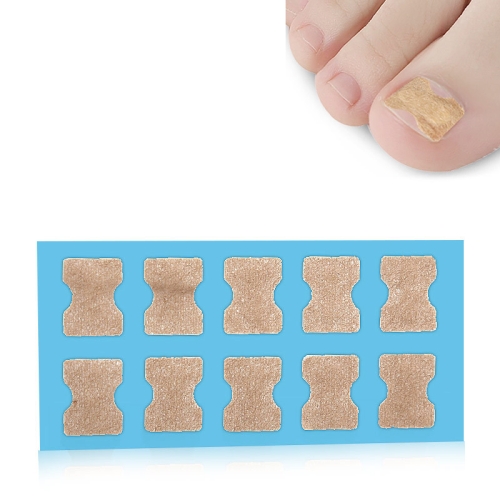 10 PCS Glue-free Orthopedic Nail Stick Toe Nail Groove Inlay Corrector(Blue  Bottom)