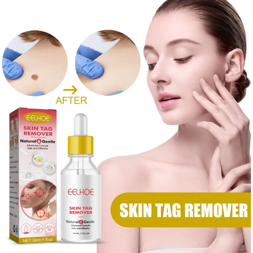 EELHOE 30ml/Bottle Anti Mole And Wart Liquid Dark Spot Tag Remover Skin Essence newest oem skintightening rf radio frequency lifting massager home skin care anti aging device wrinkle removal for face and eyes